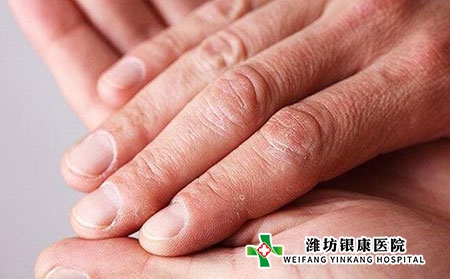 牛皮癣中医病理是什么?初期症状表现?