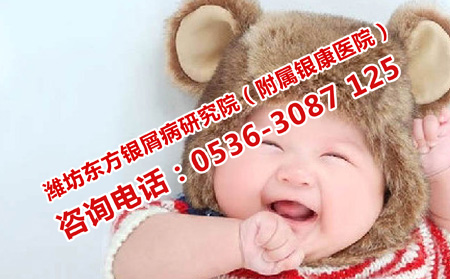 儿童牛皮癣怎么控制