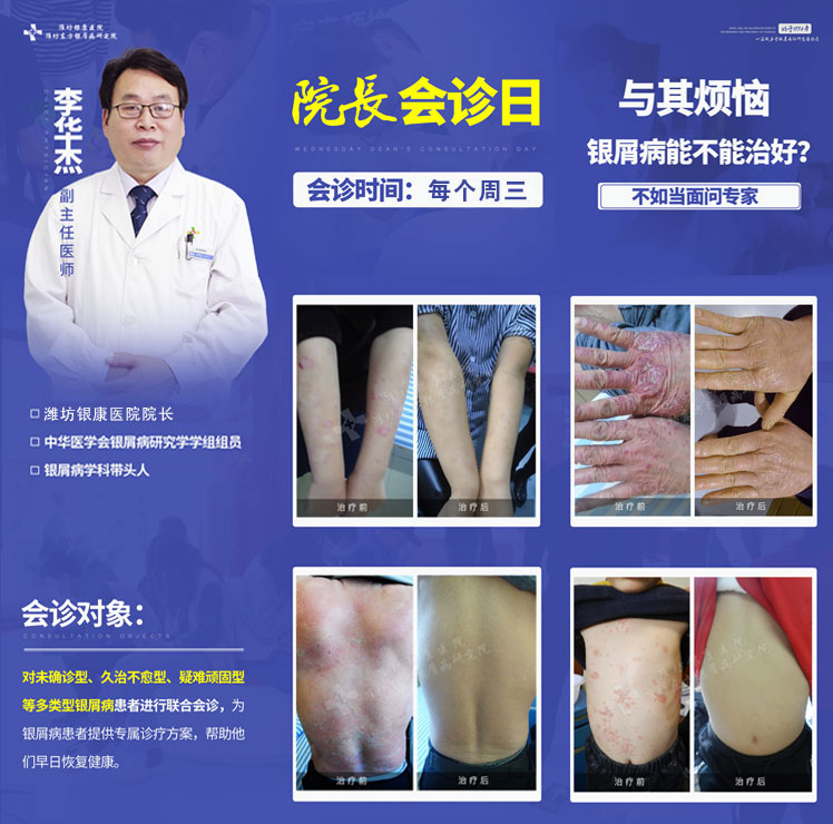 潍坊皮肤病医院周三院长会诊日