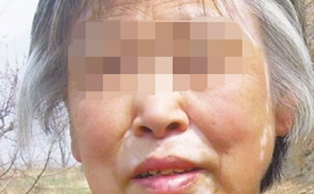 腿部白癜风,白癜风预防,白癜风常识